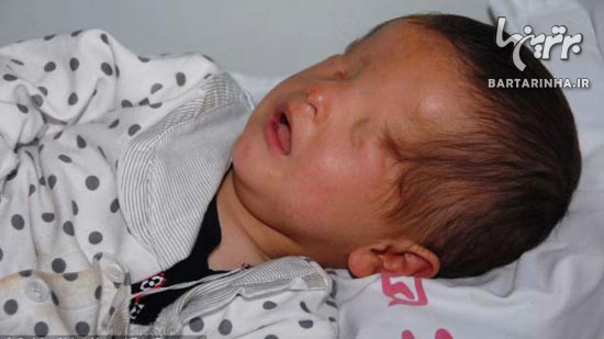 کودکی که بدون چشم به دنیا آمد+تصاویر