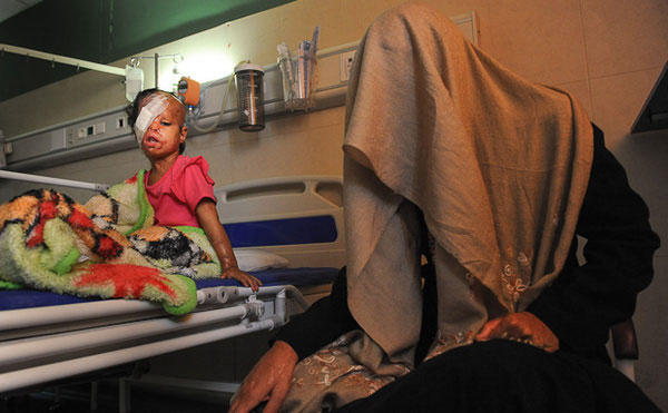 تصاویر:اسیدپاشی بر روی همسر و دختر