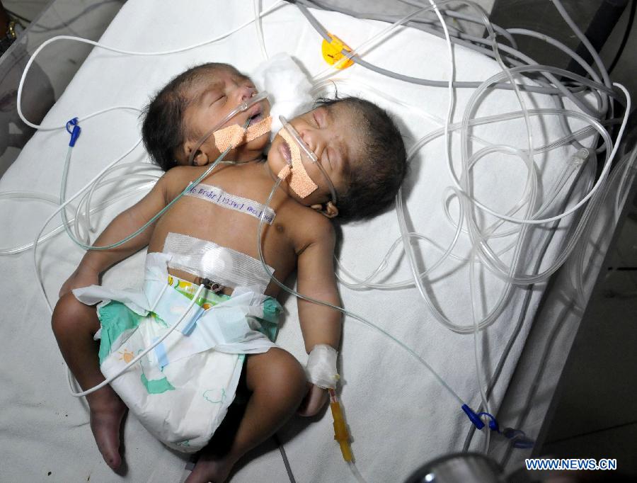 تولد نوزاد دوسر در هند/عکس