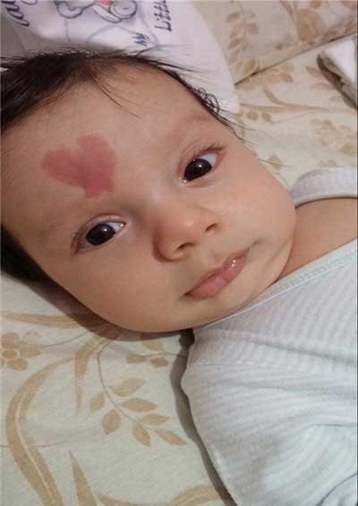 نوزادی با علامت قلب روی پیشانی (عکس)