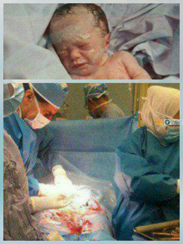 تولد جنین فریز شده پس از ۱۴ سال در اصفهان +عکس