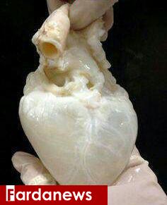 قلب انسان پس از تخلیه کامل خون (عکس)