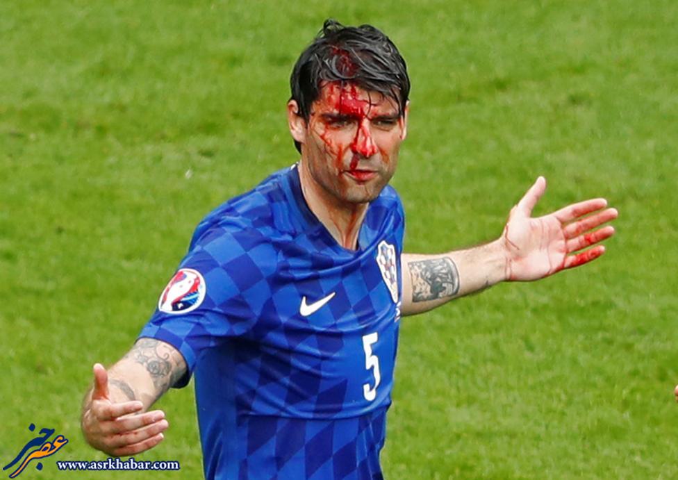 حادثه خونین در بازی ترکیه در یورو 2016 (عکس)