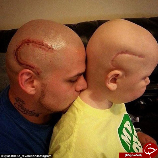 فداکاری یک پدر برای دلداری دادن به فرزند سرطانی‌اش +عکس