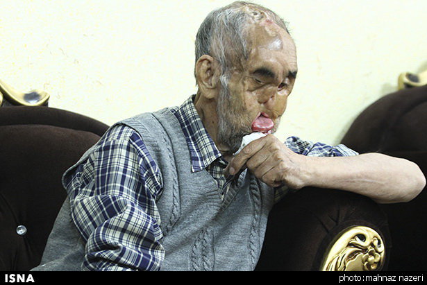 حاج رجب" در بیمارستان بستری شد
