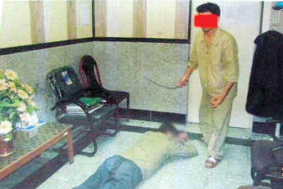 شکنجه مرگبار همسر با شیلنگ (عکس)