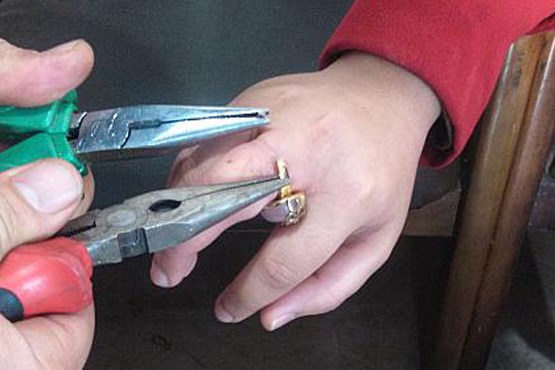 رهاسازی انگشتر تنگ از دست دختر نوجوان (عکس)