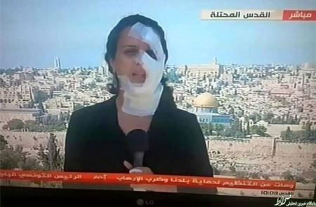 چهره عجیب خبرنگار زن در پخش زنده اخبار! (عكس)