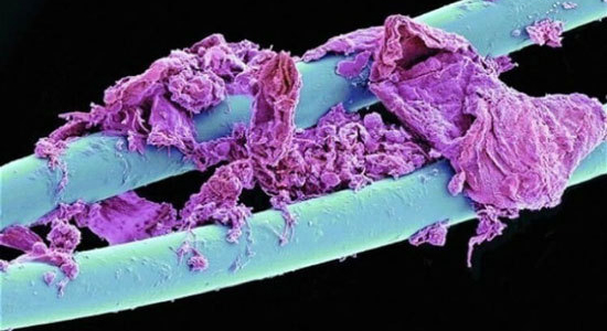 نخ دندان استفاده شده زیر میکروسکوپ (+عکس)