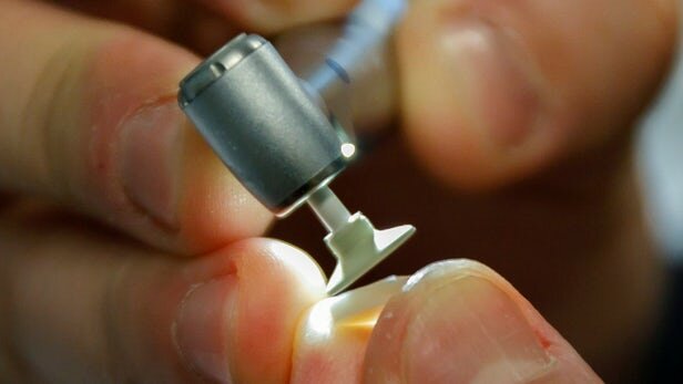 ساخت نانو مواد پیشرفته جدید برای ایمپلنت‌های دندانپزشکی