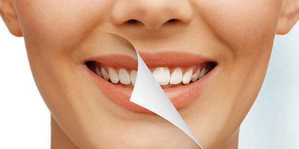 بلیچینگ دندان یا جرم گیری دندان؟ کدام مناسب تر است؟
