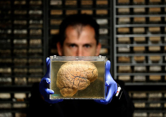 مرکزی که 3 هزار مغز انسان در آن نگهداری می‌شود (+عکس)