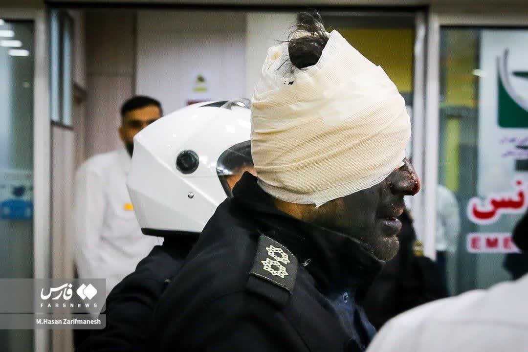 عکس | تصویری تلخ از مجروحیت یک افسر پلیس در مراسم چهارشنبه‌سوری شب گذشته