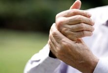تشخیص یک بیماری از روی دست‌ها