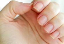 ناخن‌ها چه سرنخ‌هایی از بیماری‌های ما می‌دهند؟
