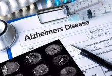 یک عامل مهم برای پیشگیری از آلزایمر را بشناسید