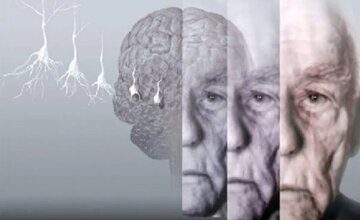 ۵ روش برای حفظ عملکرد مغز