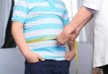 هشدار درباره روند افزایشی چاقی