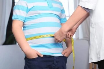 هشدار درباره روند افزایشی چاقی