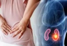 چه داروهایی برای کلیه پر خطر هستند؟