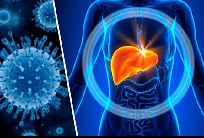 توضیح مهم یک پزشک در خصوص واگیردار بودن بیماری هپاتیت B