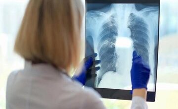 یک علت مهم و کمتر گفته شده درباره خستگی مزمن