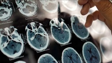 ۵ علامت هشدار دهنده پیری زودرس مغز