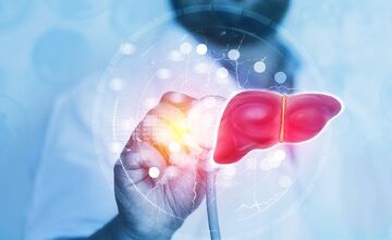 ۵ علامتی که نشان دهنده ابتلا به کبد چرب است