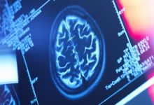 این چربیها بیسروصدا مغزتان را کوچک میکنند