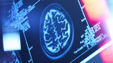 این چربیها بیسروصدا مغزتان را کوچک میکنند