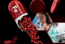 کمبود آهن چه علائمی دارد که نادیده می‌گیریم؟/ خستگی‌ مفرط ناشی از کم‌خونی است؟